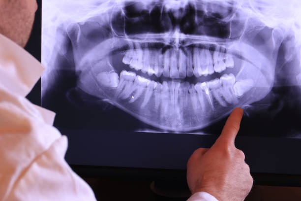 Best Emergency Dental Care for Broken or Chipped Teeth in Ash Flat, AR